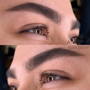 فیبروز ابرو