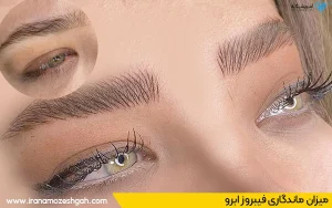 مرکز فیبروز گلدیس‌نو